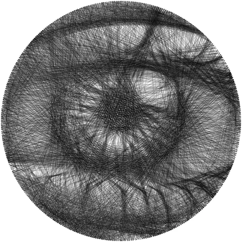 Eye
